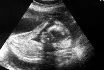 Szwecja: Chcą prawa do aborcji dla mężczyzn