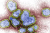 Chiny zgłaszają 5 nowych przypadków ptasiej grypy H5N6 u ludzi