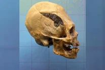 Wydłużona czaszka z metalową płytką sprzed 2 tys. lat. Niezwykłe odkrycie...