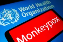 WHO potwierdza: Małpia ospa rozprzestrzenia głównie drogą seksualną